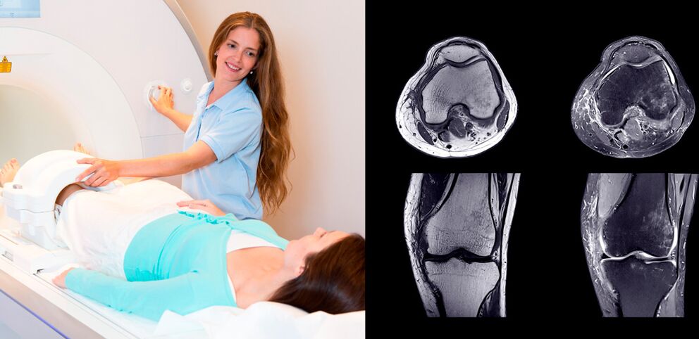 Diagnosis of the knee joint