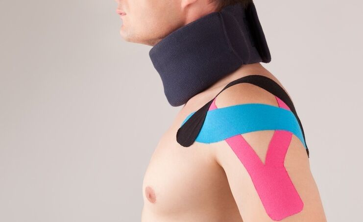 During the acute period of cervical osteochondrosis, a special collar should be worn